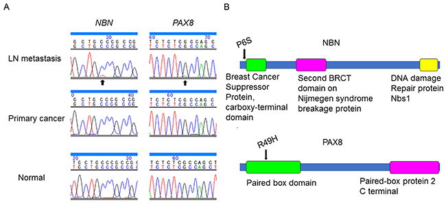 Somatic mutations in NBN and PAX8 identified in the present case.