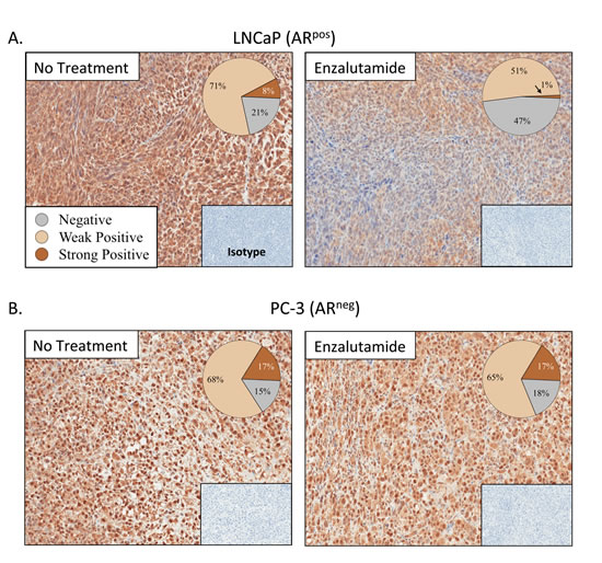 Enzalutamide reduced expression of NAIP