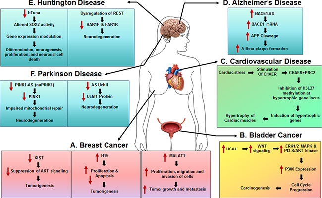 The role of lncRNAs in human diseases.