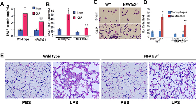NFATc3&#x2013;/&#x2013; mice subjected to abdominal sepsis by CLP show healthy lung parameters.
