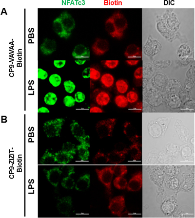 CP9-ZIZIT inhibits LPS induced NFATc3 nuclear translocation.