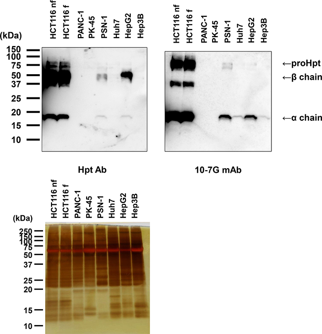 Western blot analysis of proHpt with the 10-7G mAb in conditioned media from human pancreatic cancer and hepatocellular carcinoma cell lines.