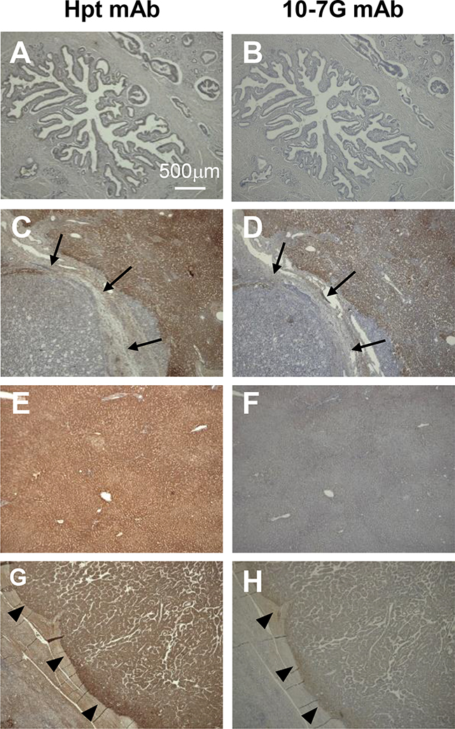 Immunohistochemical study of Fuc-Hpt in pancreatic cancer and liver tissue.