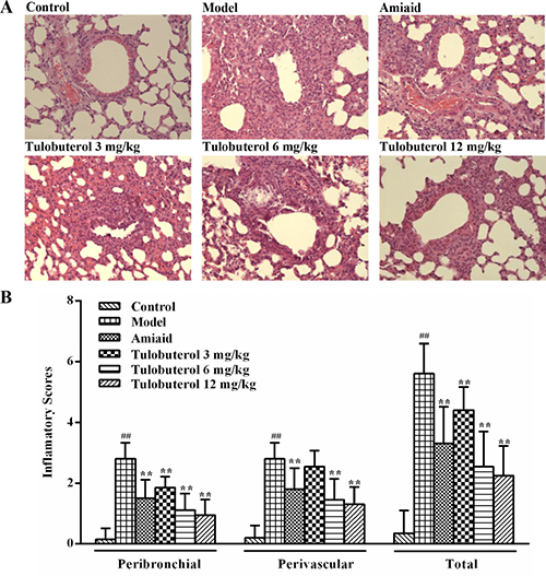 Effects of tulobuterol patch on the inflammatory cells infiltration in allergic mice.