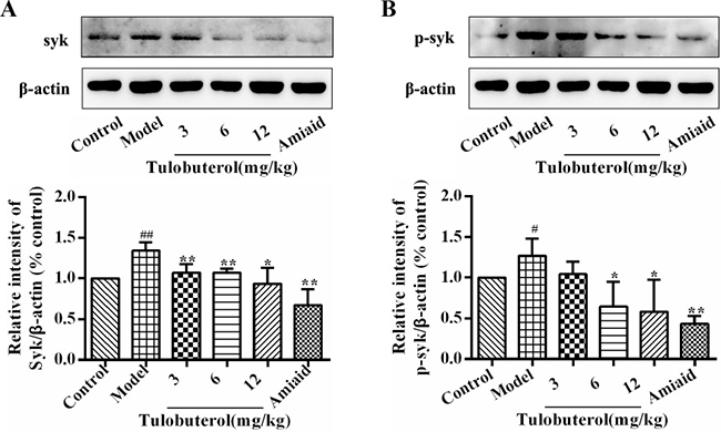 Effects of tulobuterol patch on the expression and phosphorylation of syk in lung tissue.