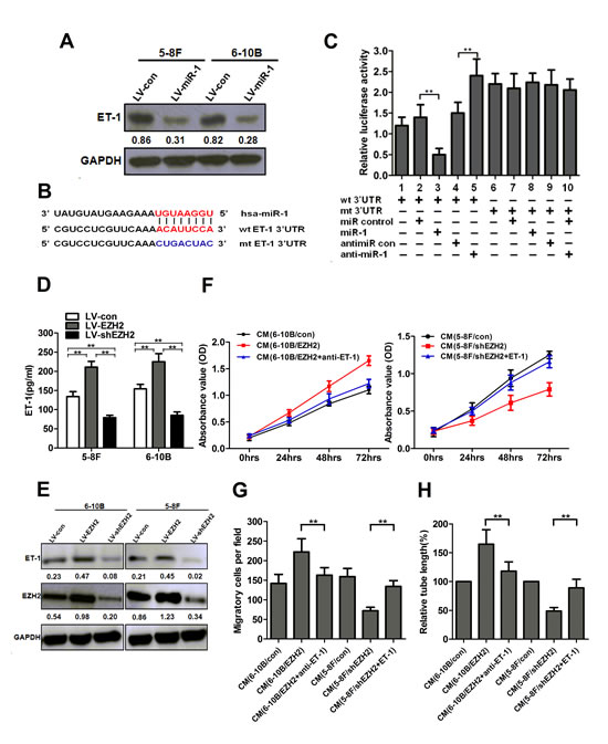 EZH2 promoted NPC angiogenesis through miR-1-mediated targeting of ET-1.