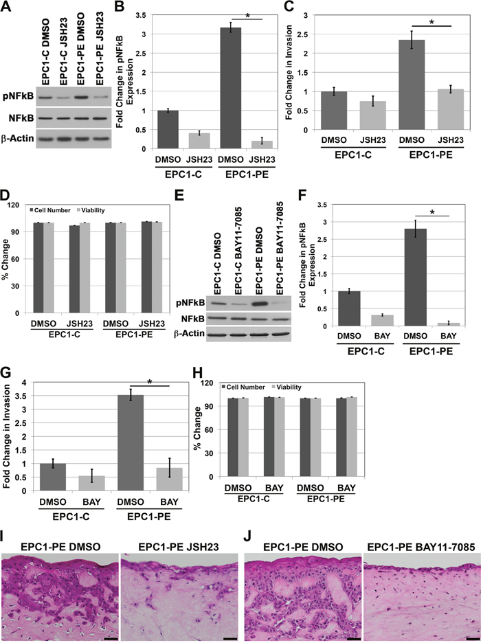 Inhibition of NFkB activity results in decreased invasion of cells with p120ctn down-regulation and EGFR overexpression.