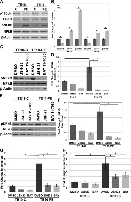 NFkB regulates invasion in human ESCC cells.