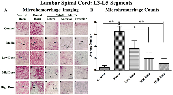 Distribution of microhemorrhages within the lumbar (L3-L5) spinal cord of G93A mice after cell transplantation.