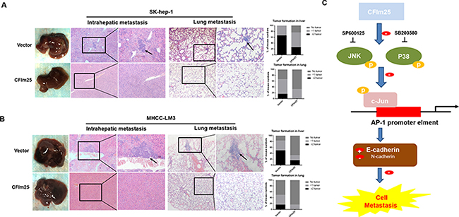 Overexpression of CFIm25 inhibits intrahepatic metastasis and lung metastasis in vivo. Representative H&#x0026;E staining of livers and lungs after injected