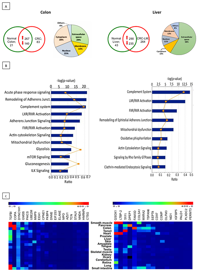 Proteomic analysis of EXPEL extruded fluid identifies potential cancer biomarkers.