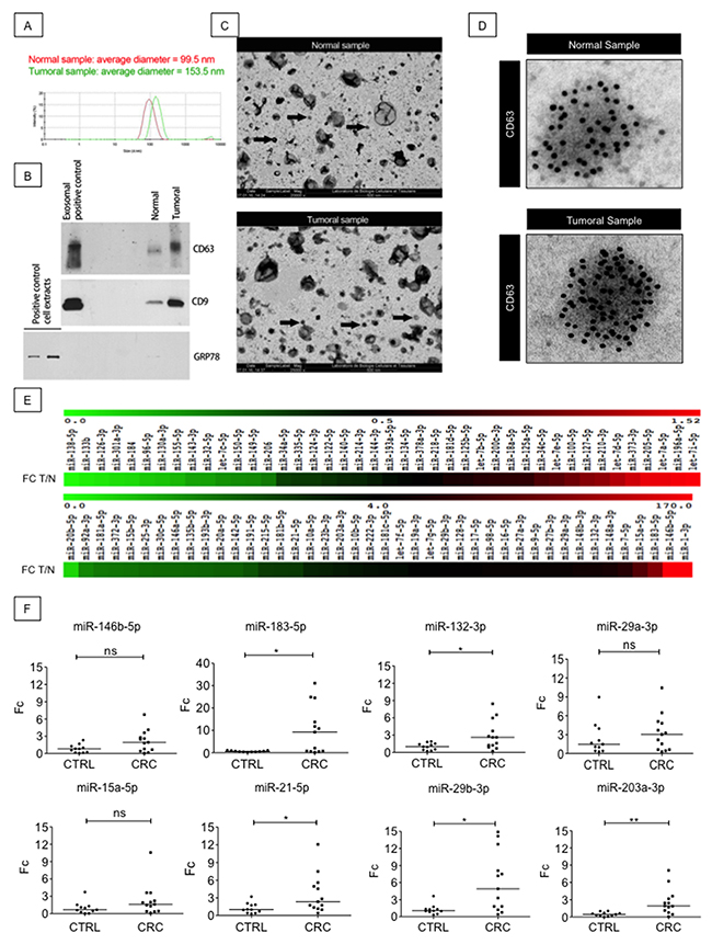 EXPEL extruded fluid contains exosomes and miRNAs readily detectable in patients sera.