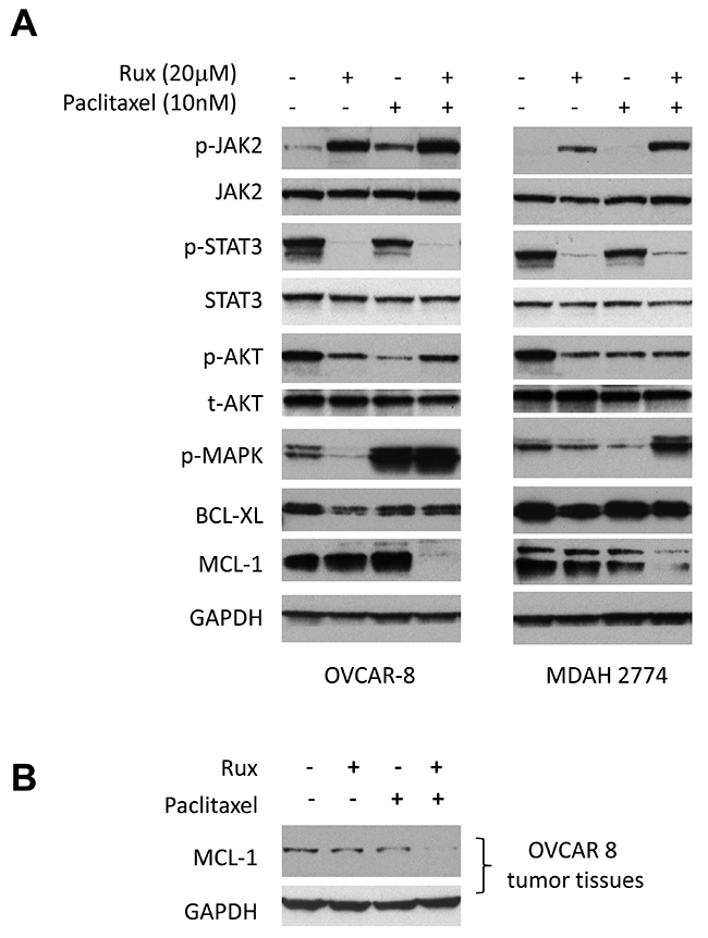Combined treatment of ruxolitinib and paclitaxel led to the reduction of MCL-1 expression.