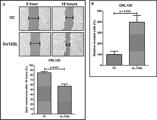 Activation of G&#x03B1;12 promotes OSCC cell migration and invasion.