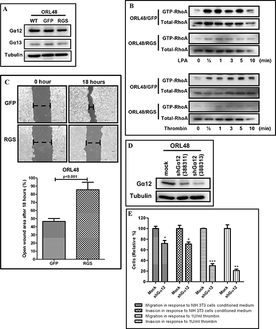 Inhibition of G12 signaling and knockdown of G&#x03B1;12 in OSCC.