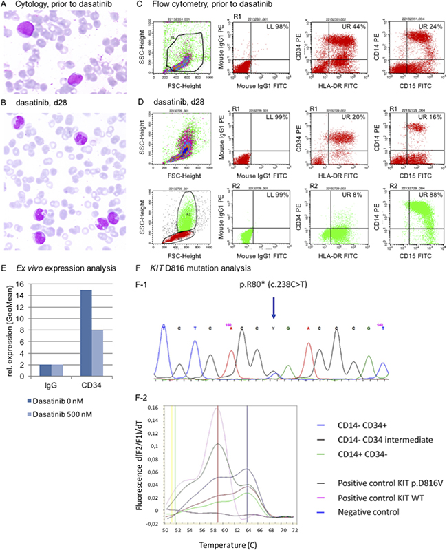 Release of the maturation blockage in leukemia cells in response to dasatinib.
