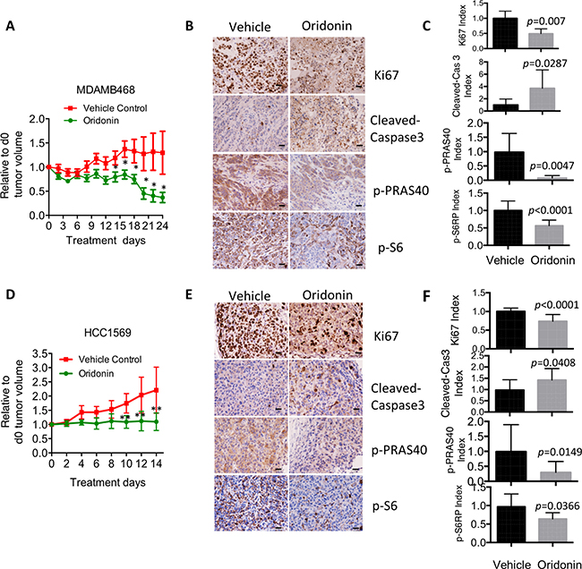 Oridonin impairs in vivo cell growth in breast cancer with hyperactivation of AKT signaling.