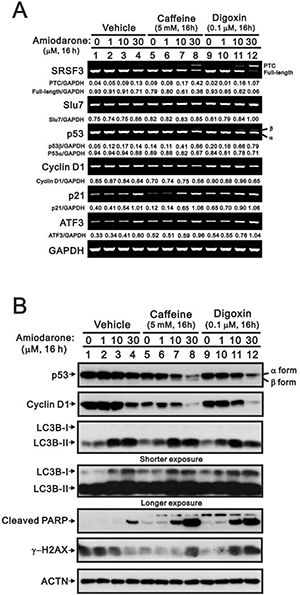 Amiodarone synergistically enhanced caffeine- or digoxin-induced SRSF3 alternative splicing and p53-independent apoptosis in HeLa cells.