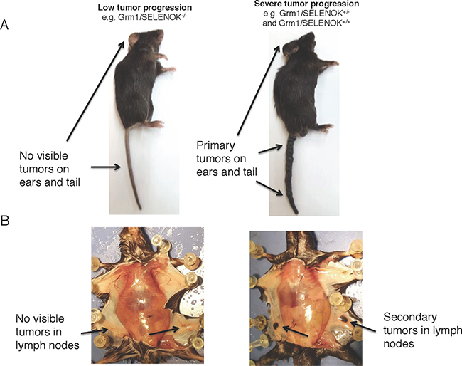 Deletion of SELENOK in vivo leads to reduced primary and secondary tumors in Grm1-Tg mice as analyzed by gross anatomy.