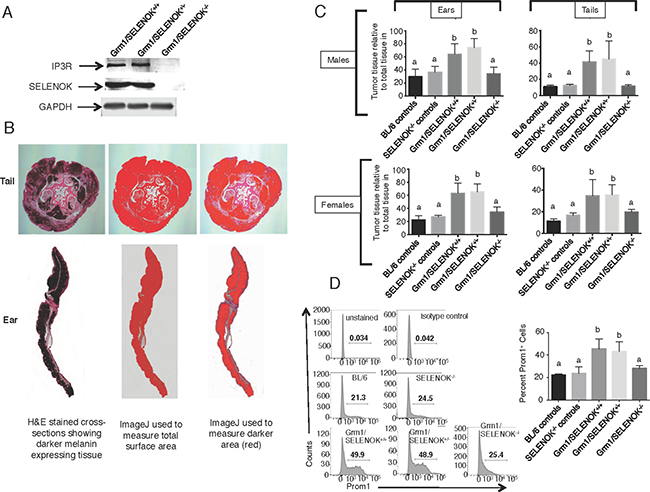 SELENOK deficiency reduces melanoma tumor growth on tails and ears.