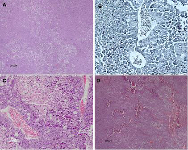 Histological analysis of melanoma tumors.