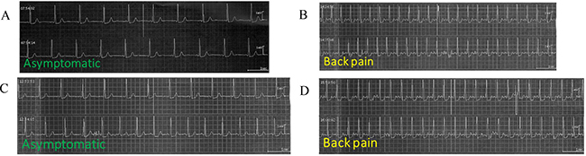 Electrocardiograms (ECGs) of patient no.