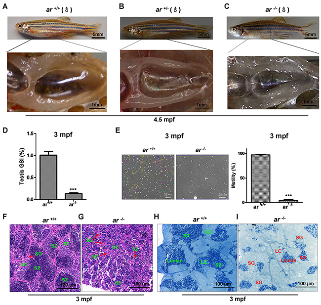 Targeted disruption of ar in zebrafish causes male infertility due to defective spermatogenesis.