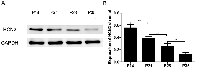 Expression of the HCN2 channel in the cortex of P14, P21, P28 and P35 mice decreased with the development of mice.