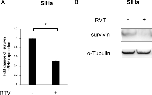 Effects of resveratrol (RVT) on survivin expression in SiHa cells.