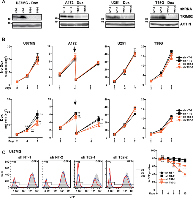 TRIM52 ablation reduces cellular fitness in a subset of glioblastoma cell lines.