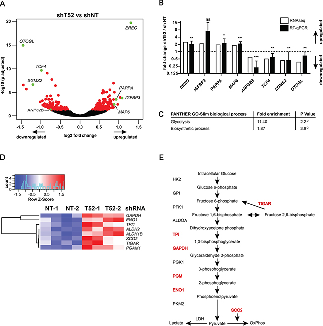 TRIM52 knockdown cells have a glucose metabolism-related gene signature.