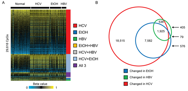 Early epimutations in cirrhosis are related to etiologic exposure.