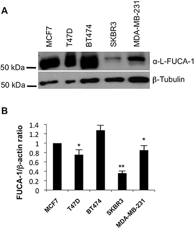 WB and qPCR in breast cancer cell lines extracts.