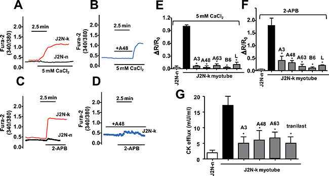 Effect of inhibitor compounds on the Ca2+ response in myocytes from hamster skeletal muscles.