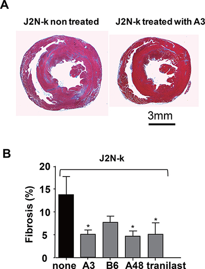 Suppression of fibrosis in the hearts of cardiomyopathic hamsters by TRPV2 inhibitors.