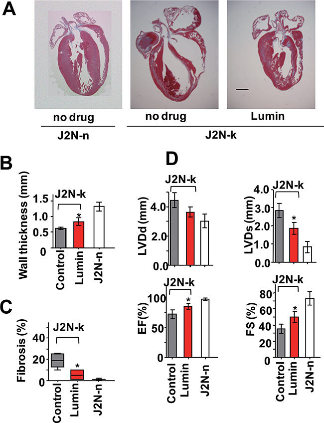 Protective effect of lumin against cardiomyopathy.