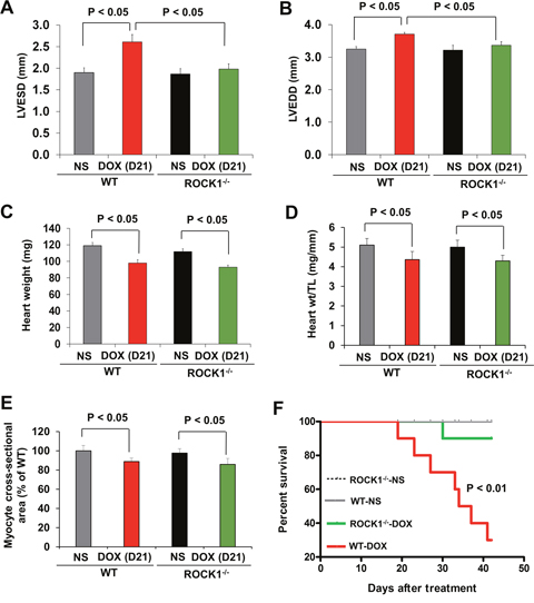 ROCK1 deficient mice are protected from doxorubicin cardiotoxicity.