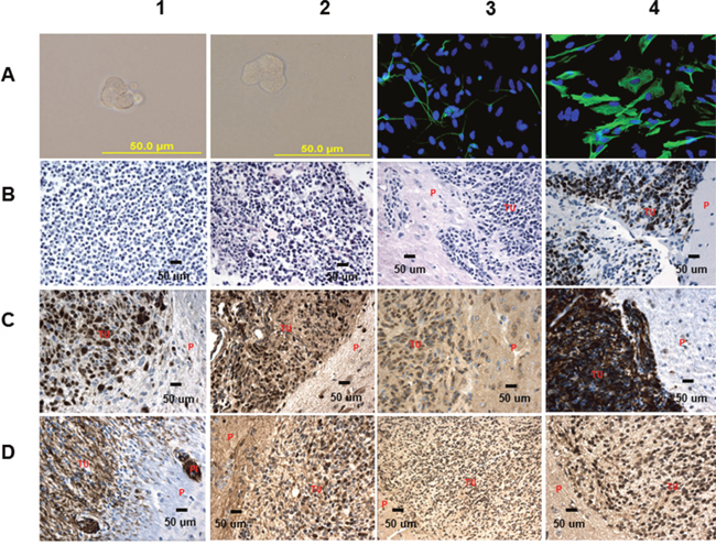 Analysis of RG, TCL and the TCL derived tumors.