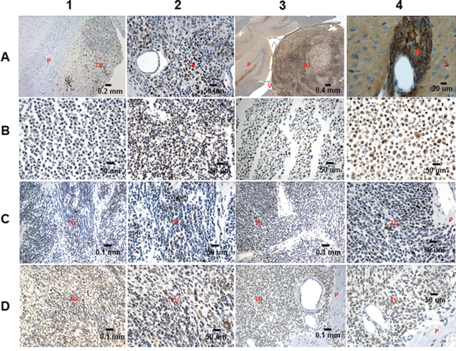 IHC analysis of RG, TCL, the RG and the TCL derived tumors.