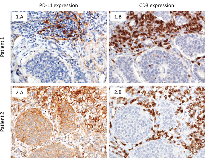 IHC assessment of FFPE archival tissue samples (x200 magnification).