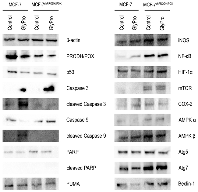 Effect of PRODH/POX silencing and GlyPro on pro-apoptotic and pro-autophagy signaling in MCF-7 cells.