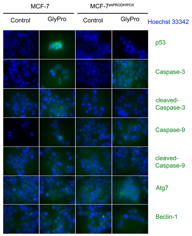 Confocal microscopy bio-imaging of p53, cleaved and un-cleaved caspase-3 and caspase-9, Atg7 and Beclin-1 in MCF-7 and MCF-7shPRODH/POX cells treated with glycyl-proline (GlyPro).
