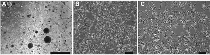 Isolation of hM1 cultures from a lung metastasis.