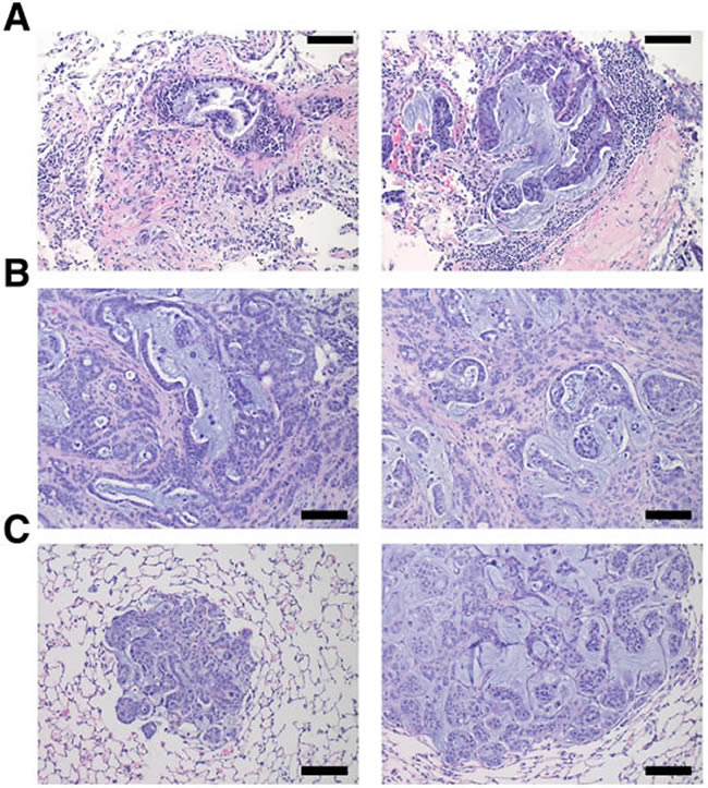 hM1 orthotopically grafted organoid (OGO) recapitulate human tumor histopathology.