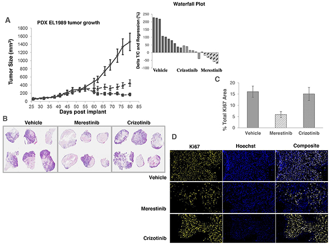 Anti-tumor activity of merestinib in patient-derived xenograft tumors (EL1989) bearing TPM3-NTRK1 fusion.