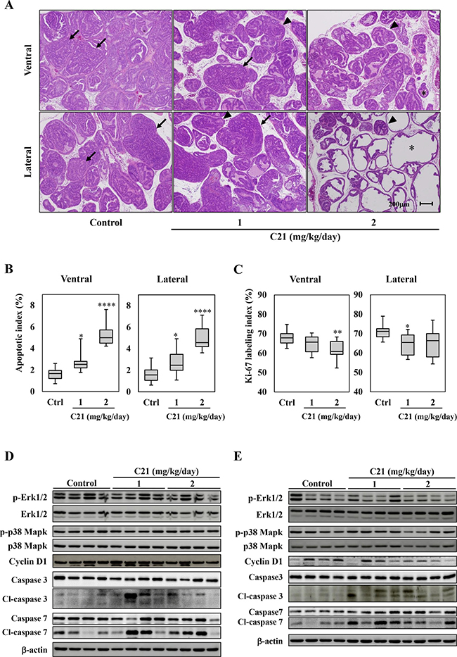 AT2R agonist supplementation suppressed the progression of prostate carcinogenesis and induced apoptosis in the TRAP model.