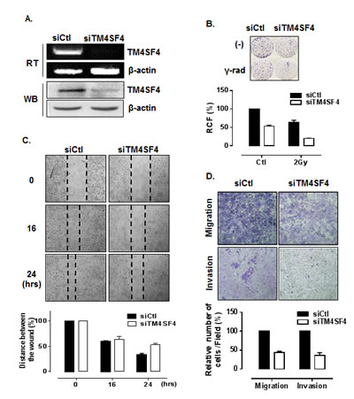 Suppression of TM4SF4 expression in A549 cells retarded cell growth, migration, and invasiveness.