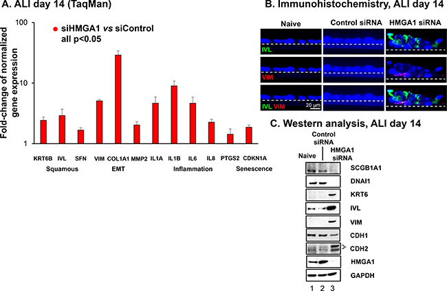 Consequences of HMGA1 silencing in airway BC on the expression of genes associated with airway remodeling in COPD.