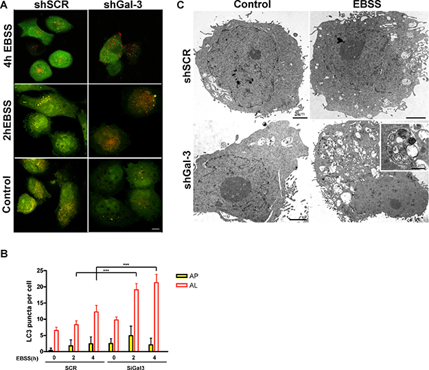 Galectin-3 inhibition increases autolysosome formation under starvation in WM1366 cells.