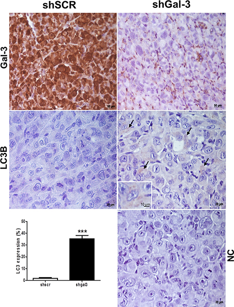 Galectin-3 and LC3B staining in melanoma tumors from mice inoculated with either shSCR or shGal-3 transduced SK-MEL-37 cells.